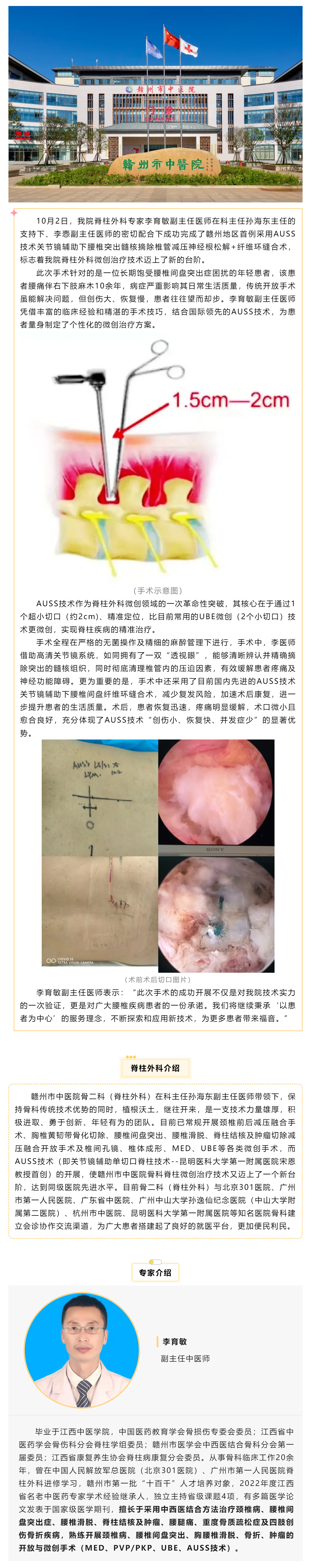 全市首例！我院成功實施AUSS技術(shù)關(guān)節(jié)鏡輔助下腰椎突出髓核摘除椎管減壓神經(jīng)根松解+纖維環(huán)縫合術(shù).png
