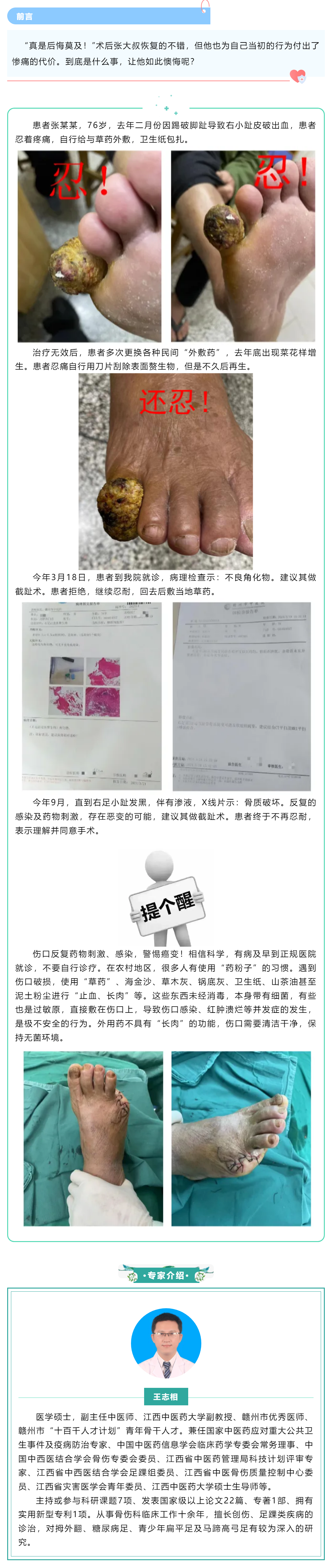 【病案實(shí)錄】小病忍、忍、忍，大病吃苦頭，多么痛的領(lǐng)悟！.png