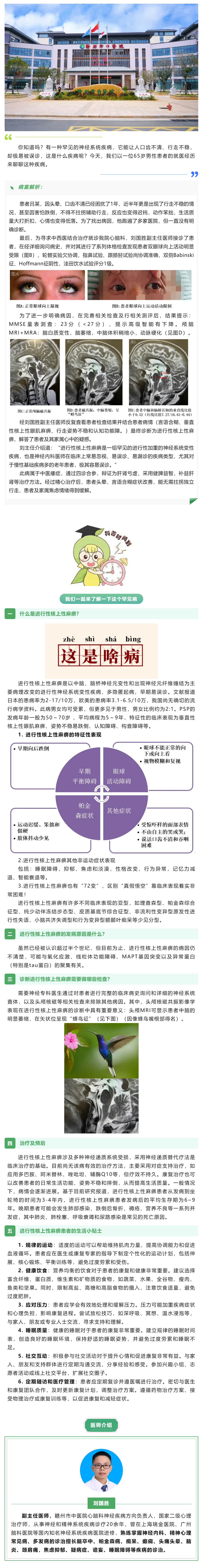 口齒不清、行走不穩(wěn)？警惕這種神經(jīng)系統(tǒng)罕見病——進行性核上性麻痹.png