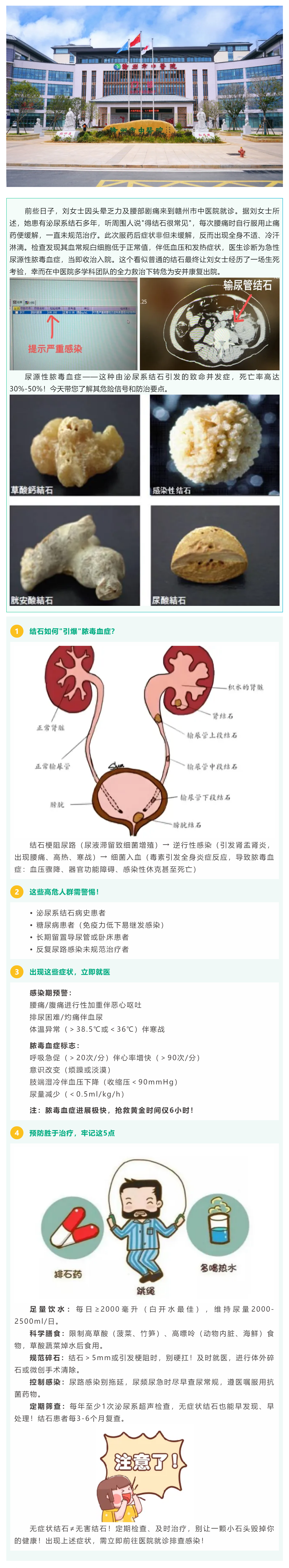 沉默的結(jié)石，暗藏的_致命危機_——警惕尿源性膿毒血癥！.png